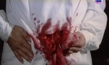 El Jorobado de la Morgue