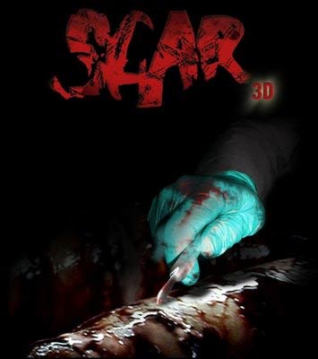 Scar 3D
