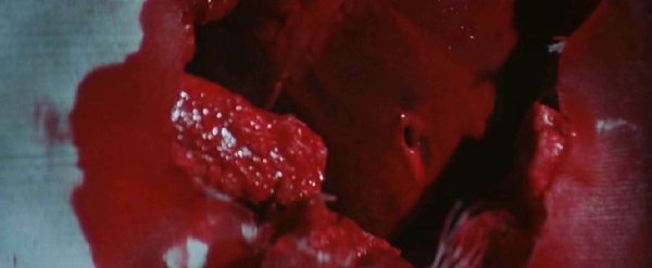 le coeur à l'ouvrage...