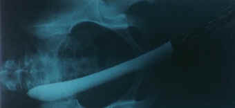 Mais... qu'avez-vous fait à Solange ? (Cosa avete fatto a Solange ?)(1972, de Massimo Dallamano)