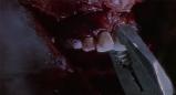 BRAIN DEAD