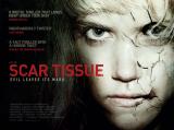 Scar Tissue